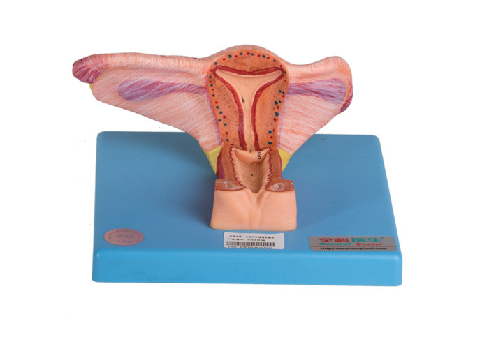 Model Organ Kelamin Dalam Wanita Menunjukkan Bagian Koronal Ovarium Dan Ureter