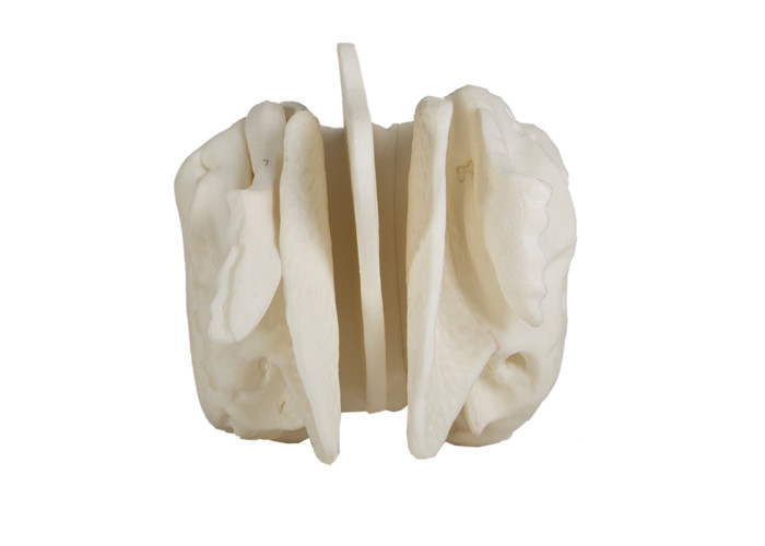 Model Tulang Etmoid Anatomi yang Diperkuat Untuk Pelatihan Medis